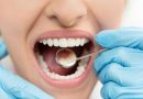 Тотальная реставрация зубов и как эта процедура способна повлиять на вашу жизнь